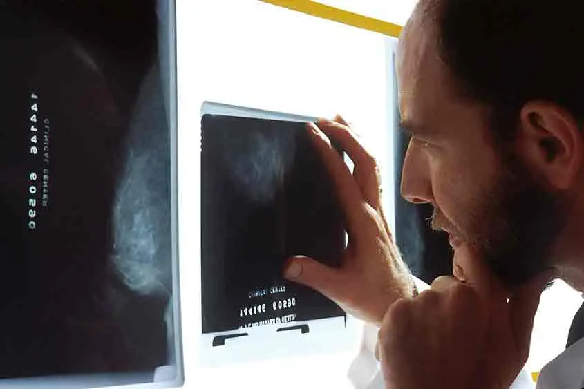 Doctor looking at an x-ray