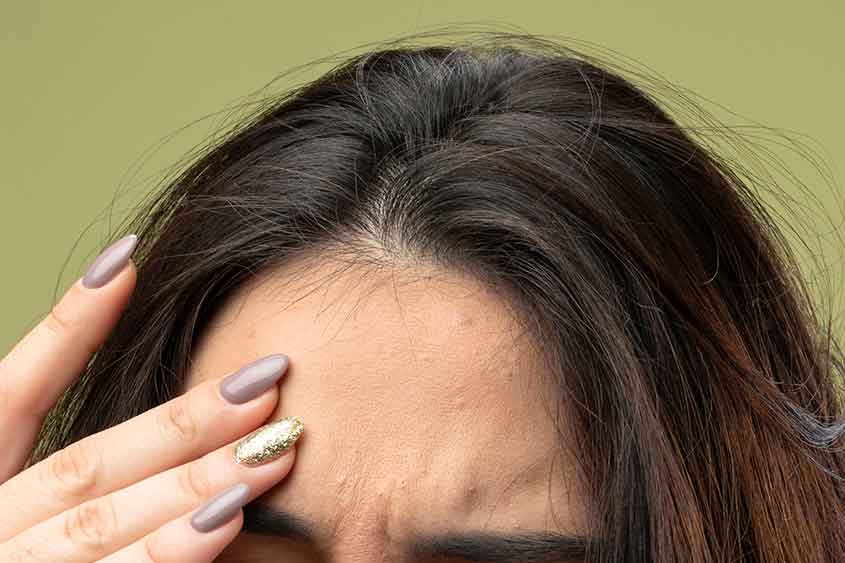 Closeup of woman holding her temples